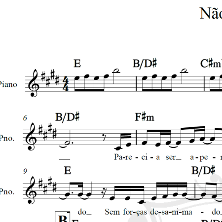 Não pare - Midian Lima - Arranjo Coral