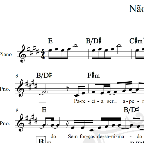 Não pare - Midian Lima - Arranjo Coral